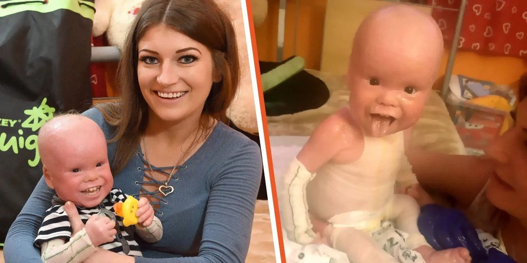 People Mistake Baby Boy for a Plastic Doll – He Turns into ‘Beautiful’ Young Man at 6