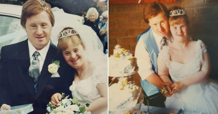 Couple with Down syndrome proved all doubters wrong: Lived happily for 25 years before tragedy struck