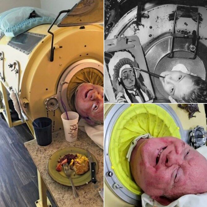 76-year-old man, paralyzed from polio at 6, is one of the last people with an iron lung: ‘My life is incredible’